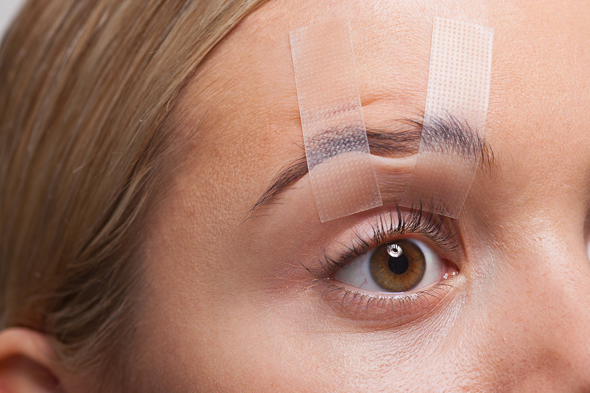 Diferença entre Ptose Palpebral e Dermatocalase